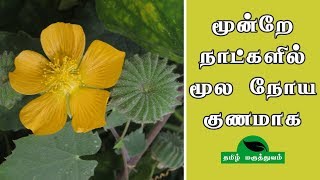 மூன்றே நாட்களில் மூல நோய் குணமாக  Thuthi ilai uses in Tamil  Abutilon Indicum for Piles [upl. by Sualkin]