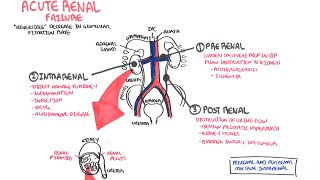 Acute Renal Failure [upl. by Nariko903]