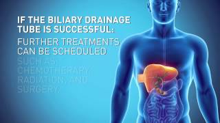 Biliary Drain [upl. by Aggarwal667]