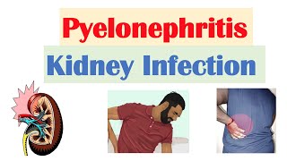 Pyelonephritis Kidney Infection  Causes Pathophysiology Signs amp Symptoms Diagnosis Treatment [upl. by Bob]