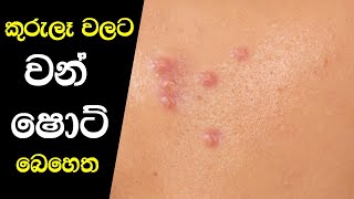 කුරුලෑ වලට වඩාත් සාර්ථක අත් බෙහෙත  Kurule Walata Sarala Behetha [upl. by Lodge527]