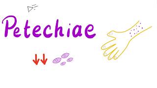 Petechiae  Medical Meaning and Pronunciation [upl. by Ahsiemal]