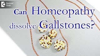 How to cure gall bladder stones in homeopathy  Dr Surekha Tiwari [upl. by Schlosser]