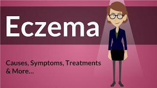 Eczema  Causes Symptoms Treatments amp More… [upl. by Allertse]