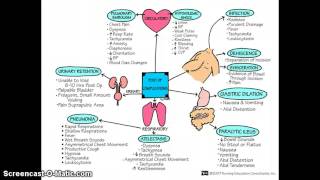 Post Operative Nursing [upl. by Huntingdon]