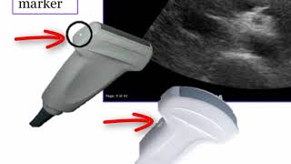 Introduction to Radiology Ultrasound [upl. by Klos561]