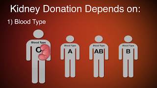 Allogeneic Bone Marrow Transplantation Process amp Donor Selection  Dr Sarita Rani Jaiswal [upl. by Forcier]