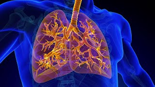 Treatment for Tracheobronchomalacia TBM [upl. by Kedezihclem571]