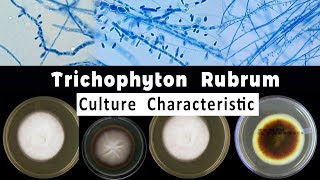 Trichophyton Rubrum culture Characteristic [upl. by Yedok]