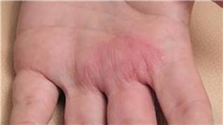 Dermatology Treatments  How to Diagnose Skin Rashes [upl. by Nevuer979]