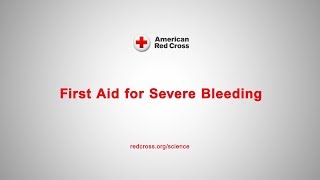 First Aid for Severe Bleeding [upl. by Gervase509]