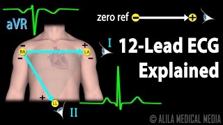 12 Lead ECG Explained Animation [upl. by Sulrac]