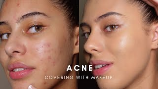 HOW TO COVER ACNE WITH MAKEUP BASE ROUTINE [upl. by Field]