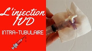 Injection IVD intra tubulaire [upl. by Atilrac]