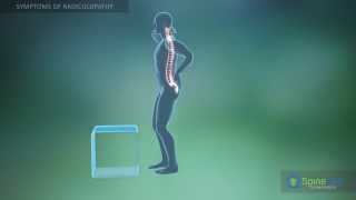 Radiculopathy Symptoms [upl. by Faustena391]