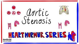 Aortic Stenosis Nursing Mnemonic  SAD [upl. by Alyl]