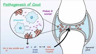 Gout  Mechanisms amp Treatment [upl. by Faria758]