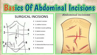 Basic Anatomy Of Abdominal Incisions l abhishekghoolibmcri [upl. by Mond588]