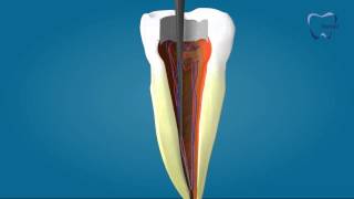 Endodoncia [upl. by Zile]