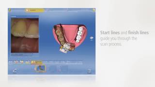 CEREC  Guided scanning [upl. by Merlina363]