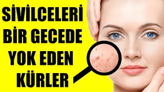 SİVİLCELERİ BİR GECEDE YOK EDEN KÜRLER [upl. by Waldon227]