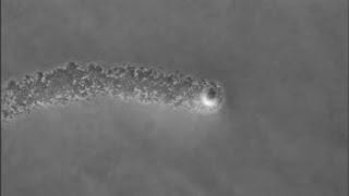 Staphylococcus aureus moves in “comets” [upl. by Asemaj]