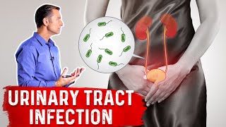 Top Natural Remedies for a UTI Urinary Tract Infection [upl. by Ahsilav]