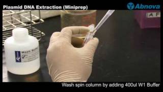 Plasmid DNA Extraction Miniprep [upl. by Irrabaj]