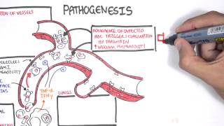 Malaria Pathophysiology [upl. by Aivad]