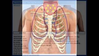 normal tracheal sound [upl. by Krum]