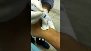 Injection in wrist joints Depo Medrol [upl. by Lajet181]