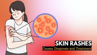 Skin Rash Causes Signs and Symptoms Diagnosis and Treatment [upl. by Ellegna]