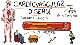 Understanding Cardiovascular Disease Visual Explanation for Students [upl. by Rakia]