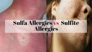 Sulfa Allergies vs Sulfite Allergies [upl. by Haidabez]