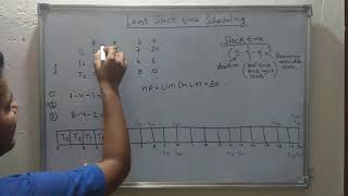 Knee Examination  Varus and Valgus Stress Tests [upl. by Leboff]