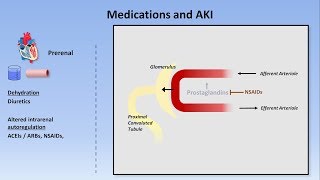 Acute Kidney Injury Part 13  Definitions and Etiologies [upl. by Edorej450]