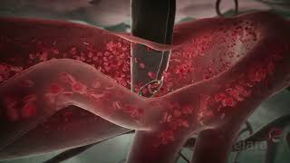 Malaria 3D Animation Shows How the Infection Spreads in the Body [upl. by Voltmer14]