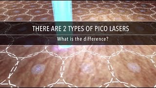 Why Are There Different Types of Pico Laser  Dr Kenneth Thean [upl. by Nwahsaj]