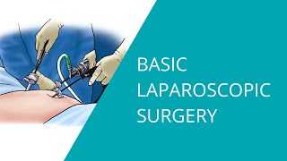 Basic Laparoscopic Surgery [upl. by Thissa]