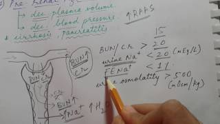 ACUTE KIDNEY INJURY  Prerenal Intrinsic renal and Postrenal azotemia  USMLE STEP 1 [upl. by Heady372]