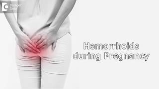 How to manage Hemorrhoids during Pregnancy  Dr Rashmi Chaudhary [upl. by Warton]