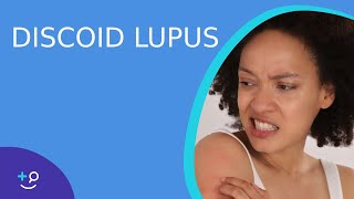 Discoid Lupus  Daily Dos of Dermatology [upl. by Freeland725]