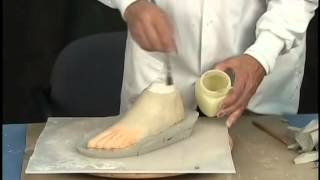 Custom Fabrication of A Silicone Partial Foot Prosthesis [upl. by Ellemac]