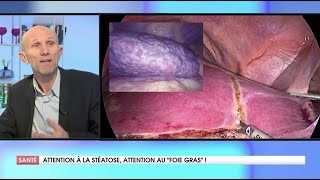 LA STÉATOSE HÉPATIQUE CEST QUOI [upl. by Atreb]