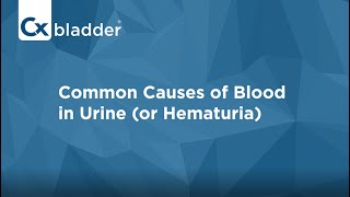 What Causes Blood in Urine  Cxbladder [upl. by Enneibaf]