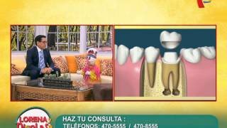 La Endodoncia y su Complicaciones [upl. by Laban]