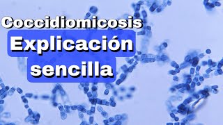 Coccidiomicosis fácil explicación [upl. by Hale349]