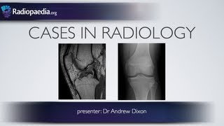 Cases in Radiology Episode 4 musculoskeletal MRI xray [upl. by Uund]