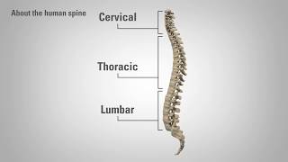 Radiculopathy  Patient Education [upl. by Ravilob]