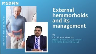 What are external hemorrhoids [upl. by Reteid]